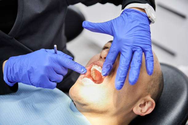 Best Emergency Dental Care for Broken or Chipped Teeth in Slater Marietta, SC